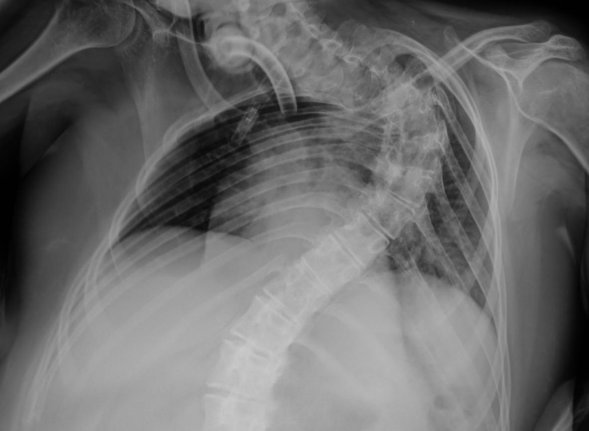 Exame Médico